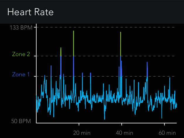 Heart tachycardia